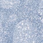 HSD17B13 Antibody in Immunohistochemistry (IHC)