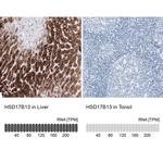 HSD17B13 Antibody