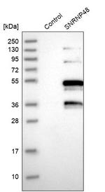 SNR48 Antibody in Western Blot (WB)