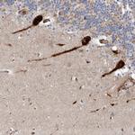 USF3 Antibody in Immunohistochemistry (IHC)