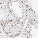 SPT5 Antibody in Immunohistochemistry (IHC)