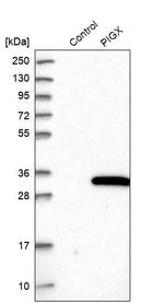 PIGX Antibody in Western Blot (WB)