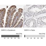 RCL Antibody in Immunohistochemistry (IHC)