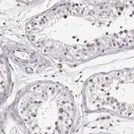 RCL Antibody in Immunohistochemistry (IHC)