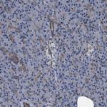 Plectin Antibody in Immunohistochemistry (IHC)