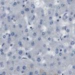 Plectin Antibody in Immunohistochemistry (IHC)