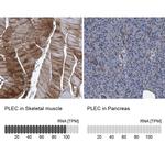 Plectin Antibody