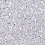 NUDT17 Antibody in Immunohistochemistry (IHC)