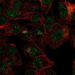 FBXO31 Antibody in Immunocytochemistry (ICC/IF)