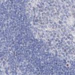 FRS3 Antibody in Immunohistochemistry (IHC)