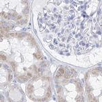 FRS3 Antibody in Immunohistochemistry (IHC)