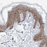 ZNF710 Antibody in Immunohistochemistry (IHC)