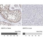 ABCF2 Antibody in Immunohistochemistry (IHC)