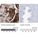 TXLNB Antibody in Immunohistochemistry (IHC)