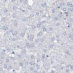 TXLNB Antibody in Immunohistochemistry (IHC)