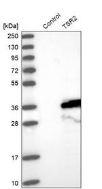 TSR2 Antibody in Western Blot (WB)