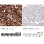 LPIN2 Antibody in Immunohistochemistry (IHC)