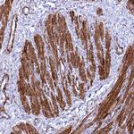 SYNPO2 Antibody in Immunohistochemistry (IHC)