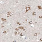 RCN2 Antibody in Immunohistochemistry (IHC)