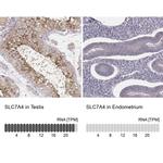 SLC7A4 Antibody