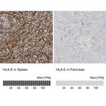 HLA-E Antibody in Immunohistochemistry (IHC)