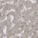 XTP3B Antibody in Immunohistochemistry (IHC)