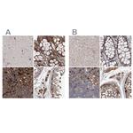 ASCC3 Antibody in Immunohistochemistry (IHC)