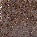 ASCC3 Antibody in Immunohistochemistry (IHC)