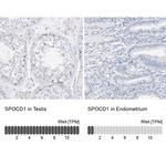 SPOCD1 Antibody in Immunohistochemistry (IHC)