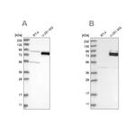 COLGALT2 Antibody in Western Blot (WB)