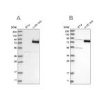 COLGALT2 Antibody in Western Blot (WB)