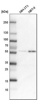 COLGALT2 Antibody in Western Blot (WB)