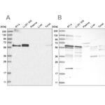 TSPYL1 Antibody in Western Blot (WB)