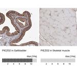 PIEZO2 Antibody