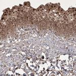 PLEKHM2 Antibody in Immunohistochemistry (IHC)