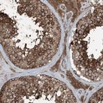 RAB3GAP1 Antibody in Immunohistochemistry (IHC)