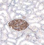 SYNPO Antibody in Immunohistochemistry (IHC)