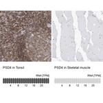 PSD4 Antibody in Immunohistochemistry (IHC)