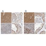 C13orf7 Antibody in Immunohistochemistry (IHC)