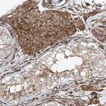 UBTD1 Antibody in Immunohistochemistry (IHC)