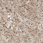 ZBTB41 Antibody in Immunohistochemistry (IHC)