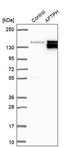 AFTPH Antibody in Western Blot (WB)