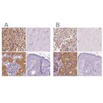 GALM Antibody in Immunohistochemistry (IHC)