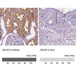 GALM Antibody