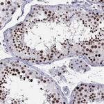 PPM1G Antibody in Immunohistochemistry (IHC)