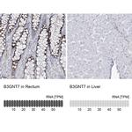 B3GNT7 Antibody in Immunohistochemistry (IHC)