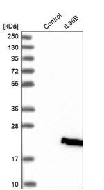 IL36B Antibody in Western Blot (WB)