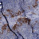 SLC4A7 Antibody in Immunohistochemistry (IHC)