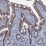 SLC4A7 Antibody in Immunohistochemistry (IHC)