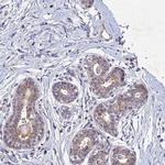 PTHLH Antibody in Immunohistochemistry (IHC)